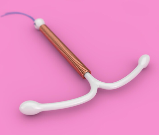 Inserción y retiro de implante intrauterino (DIU)